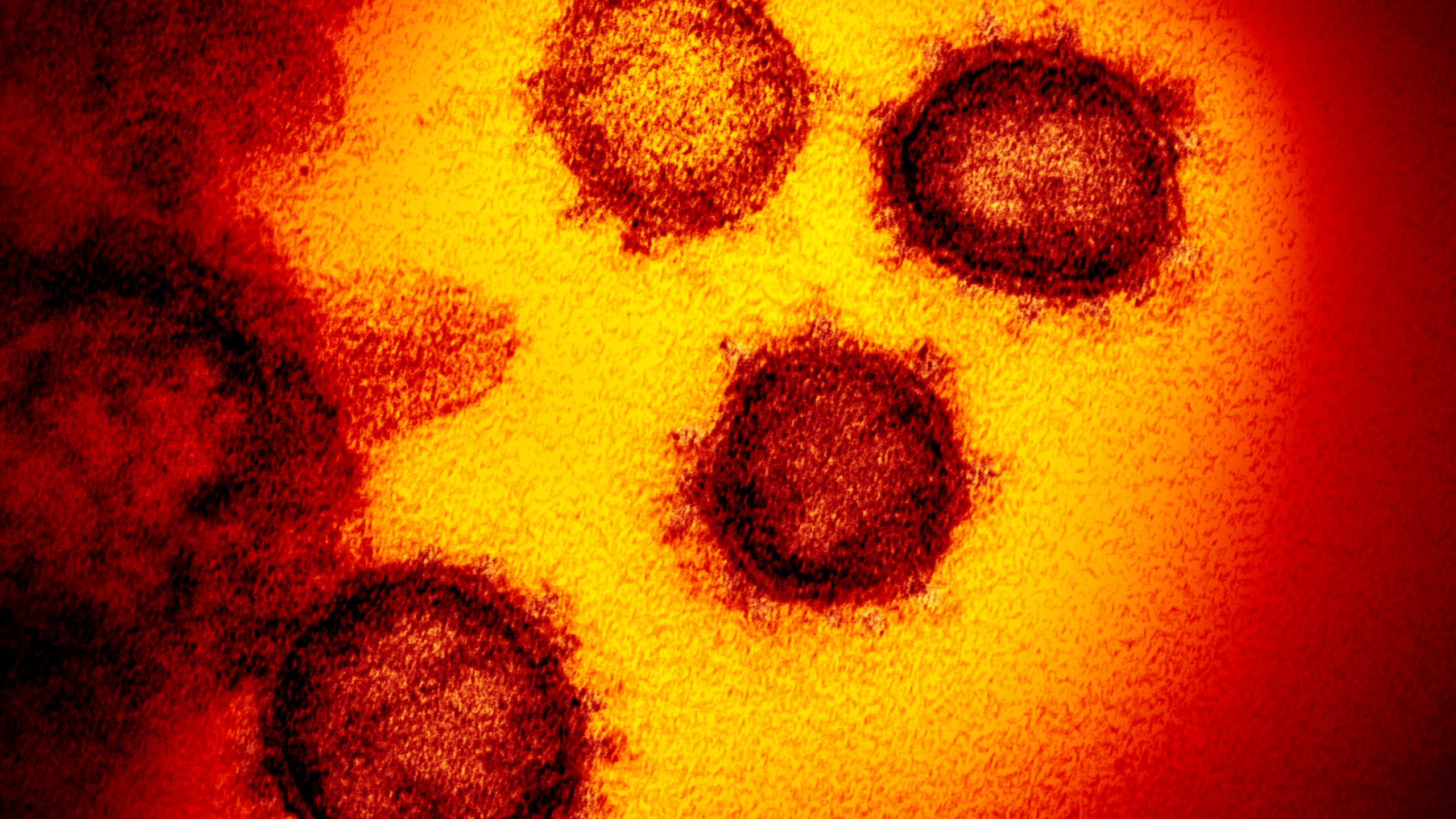 Picture of coronavirus under microscope