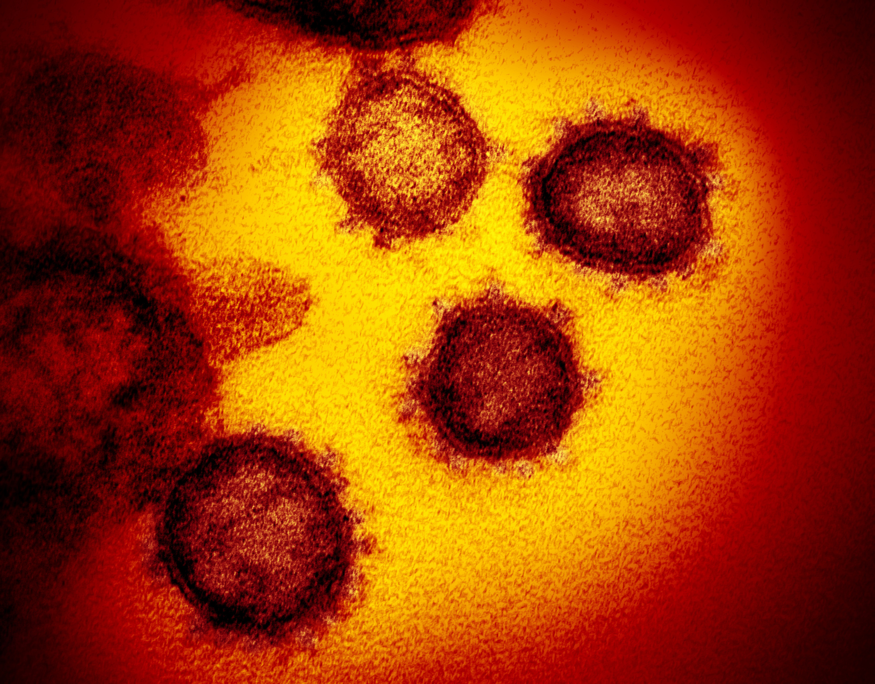 Picture of coronavirus under microscope