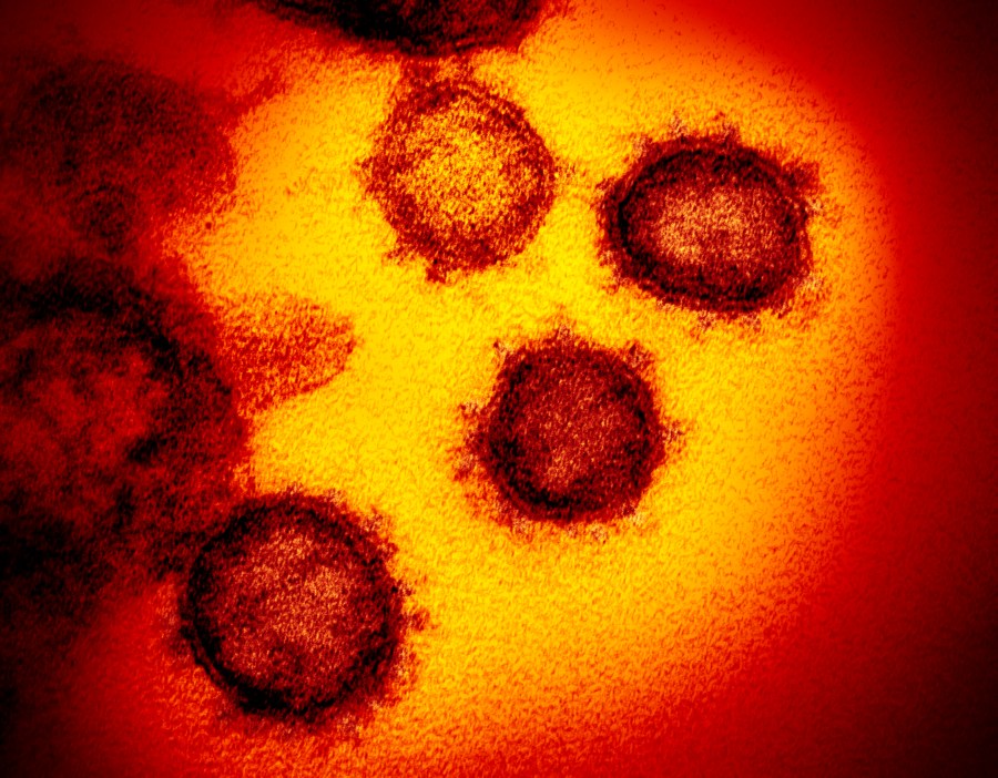 Picture of coronavirus under microscope